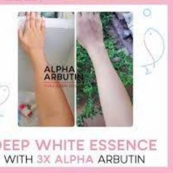 (Hàng Mới Về) Xà Phòng Làm Trắng Da Chứa Collagen Alpha Arbutin 3 Plus