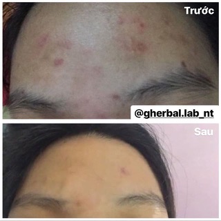 [SALE] bột diếp cá gói lớn