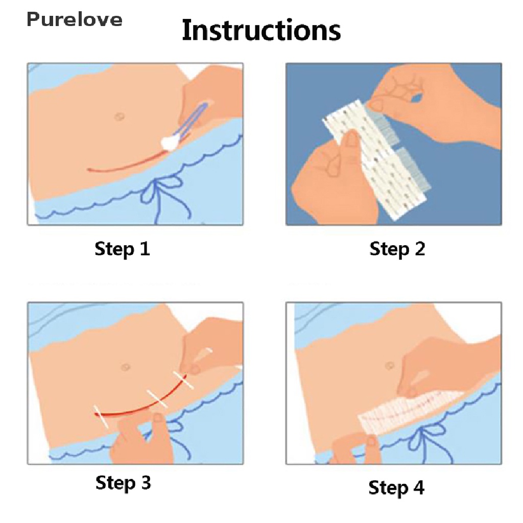 Băng Y Tế Giúp Phục Hồi Hư Tổn