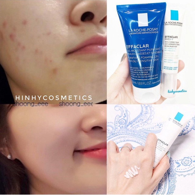 Set mụn Duo+ tặng kèm srm Effaclar Laroche Posay | BigBuy360 - bigbuy360.vn