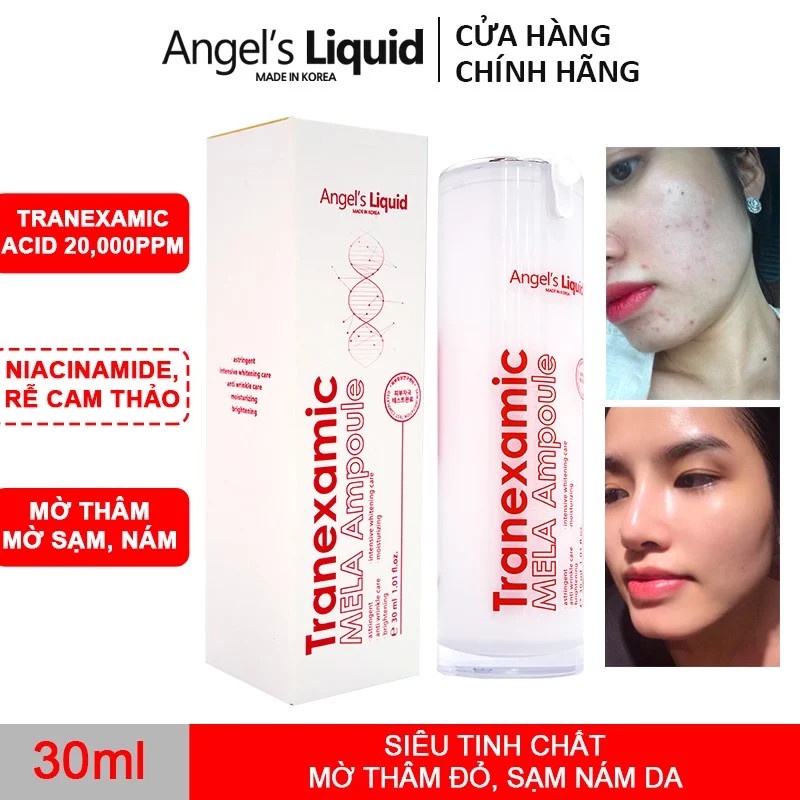 Siêu Tinh Chất Xoá Thâm Đỏ, Mờ Sạm Nám Angel's Liquid Tranexamic Mela Ampoule 30ml