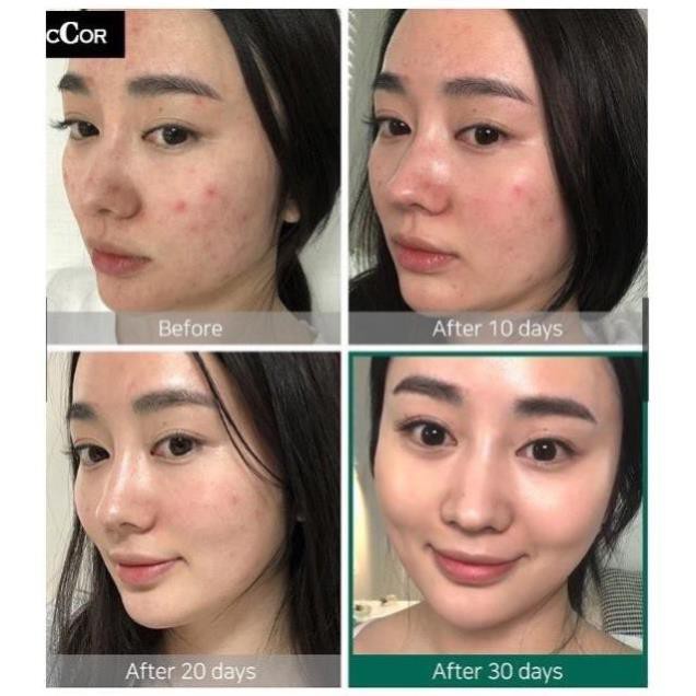 Nước Hoa Hồng , nước hoa hồng dành cho da mụn | BigBuy360 - bigbuy360.vn