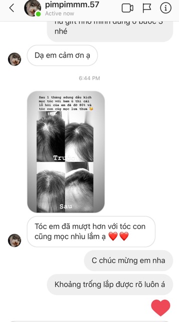 Dầu ủ OIL TREATMENT - |TẶNG Kem ủ + Mũ Trùm | | BigBuy360 - bigbuy360.vn