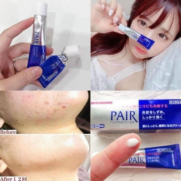 🎀 Kem Ngừa Mụn 🎀 Pair Acne W Cream Nhật Bản 14g