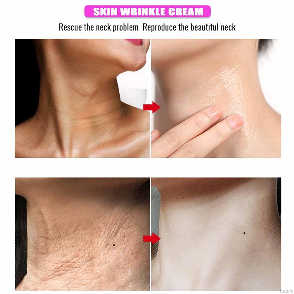 Anti Wrinkle Face & Neck Cream Body Whitening Anti-Aging Wrinkle Moisturizing Cream Faceial Tender Skin Care Beauty