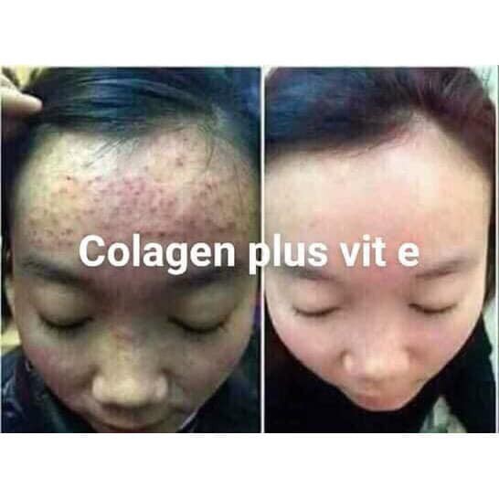 Cam Kết Hàng Chuẩn Kem Ngày Và Đêm Face Collagen Plus Vit E