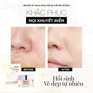 Ceranee Dưỡng Trắng Căng Bóng