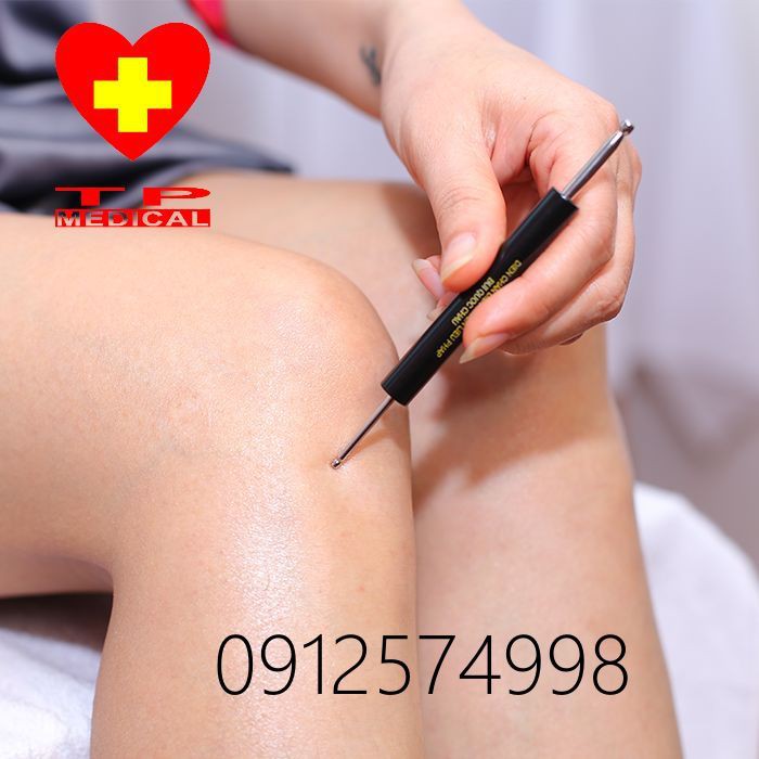 Dụng cụ diện chẩn- Cây Dò huyệt 2 đầu