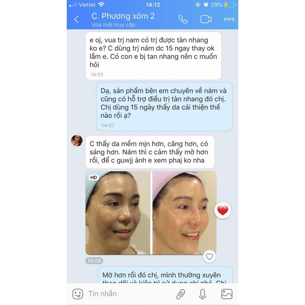 (+Quà) Bộ Vua Kem Nám I’M NATURE - Da Sáng Hồng Đẹp Rạng Rỡ Sau 15 Ngày | BigBuy360 - bigbuy360.vn