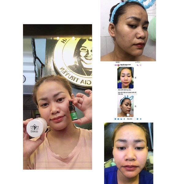 Kem face dưỡng da trăng hồng V1, dưỡng ẩm cho làn da sáng bóng mịn màng