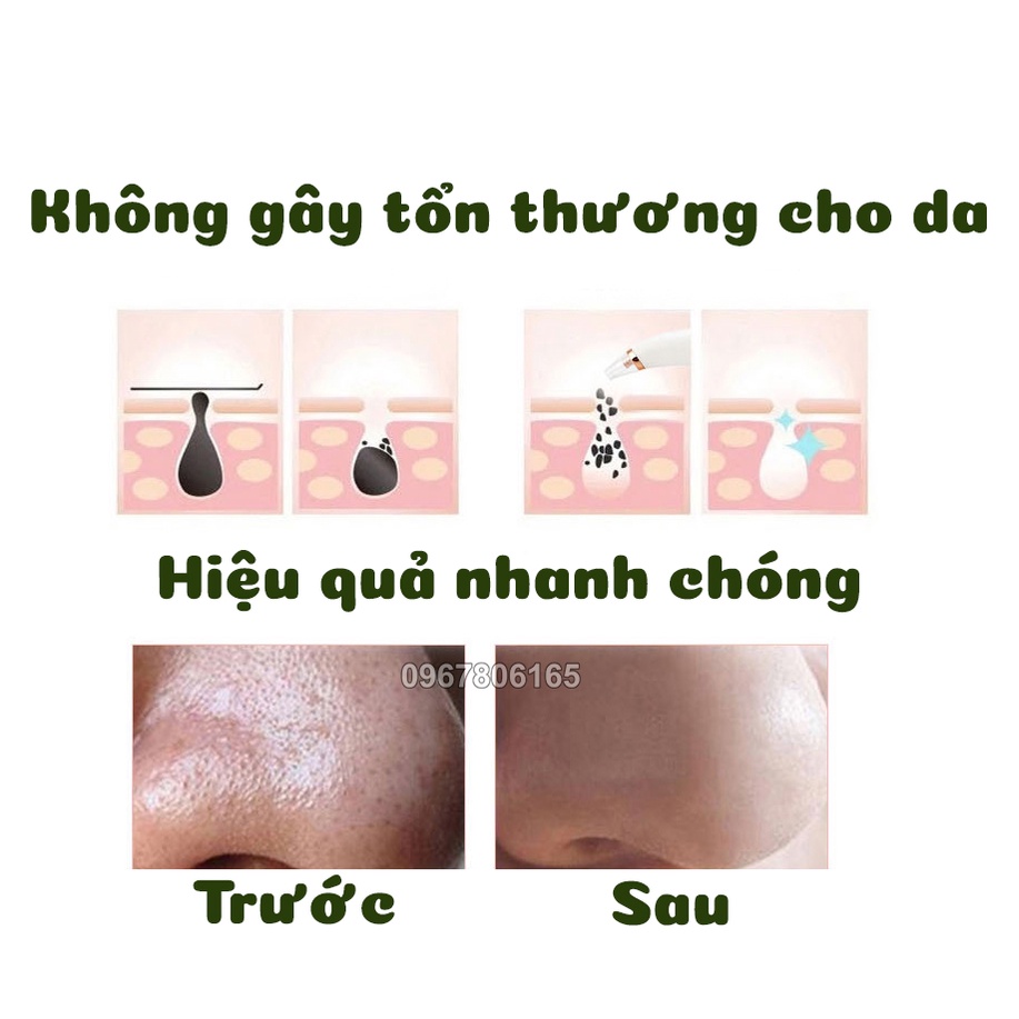 Máy Hút Mụn Cầm Tay Cao Cấp Black Head 2 Nấc Full 3 Đầu