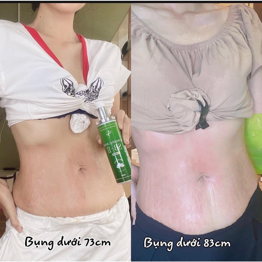 Bộ quấn nóng thải mỡ SLIMMING CARE