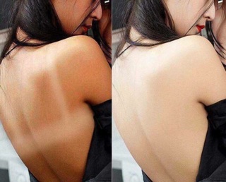 Tắm trắng quyên lara
