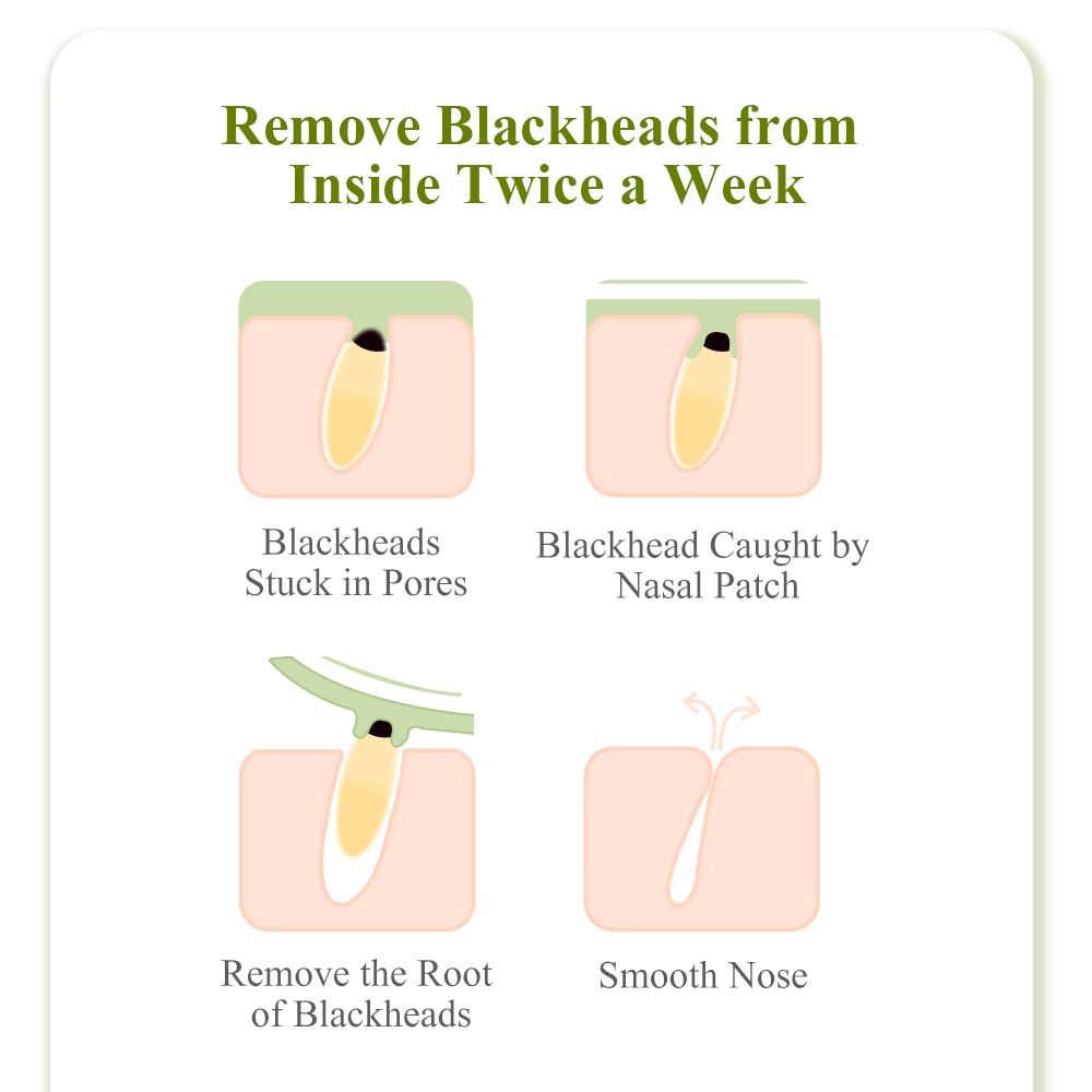 [Hàng mới về] Miếng Dán Mũi Breylee Làm Sạch Sâu Cho Da | BigBuy360 - bigbuy360.vn