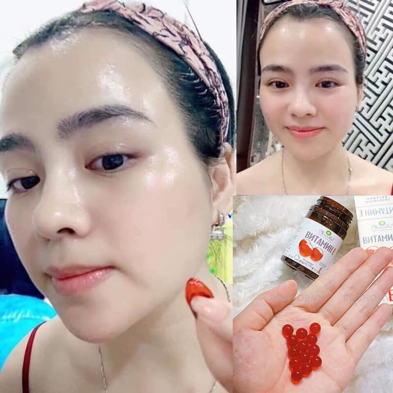 Vitamin E Đỏ Nga Mirolla 270Mg Chính Hãng Gấp 5 Lần E Vàng Bình Thường Da Mặt Tươi Sáng Hồng Hào Giảm Sạm Nám Mụn