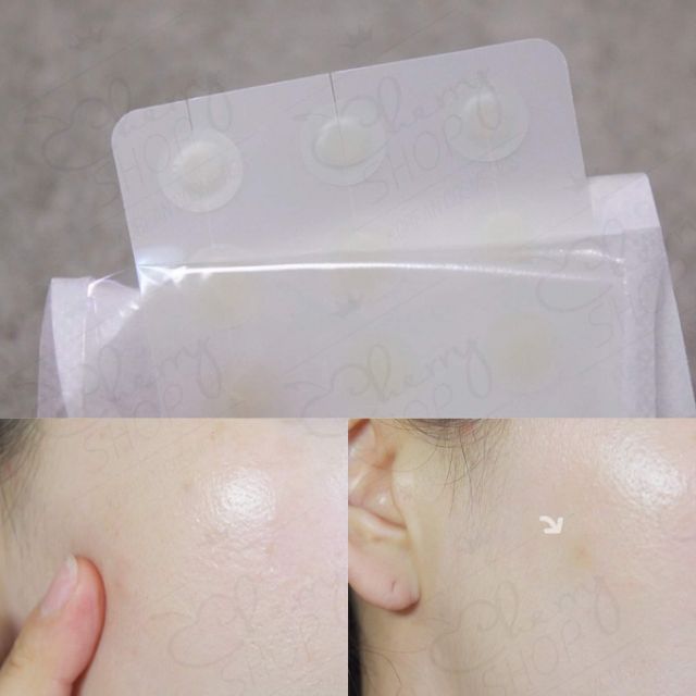 🍒Miếng dán mụn Cosrx Clear Fit Master Patch | BigBuy360 - bigbuy360.vn