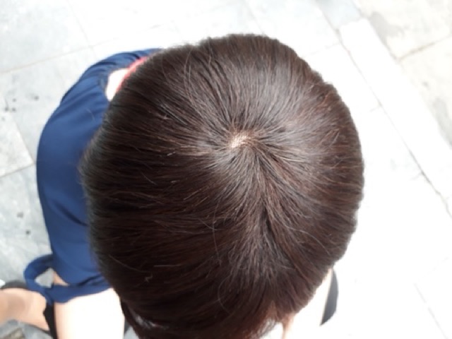 Miếng che hói đỉnh đầu - chất liệu tóc thật