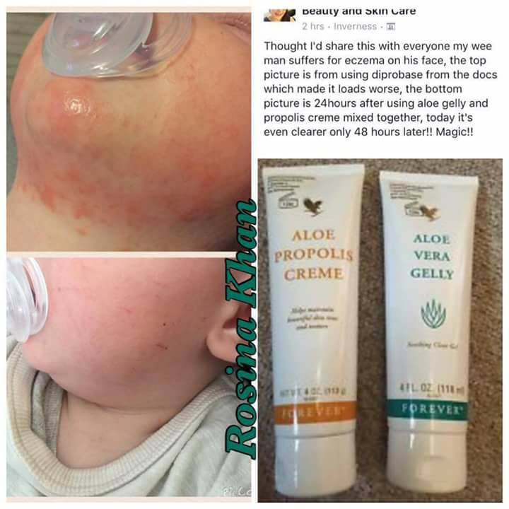 Combo 2 kem dưỡng da aloe vera gelly và aloe propolis