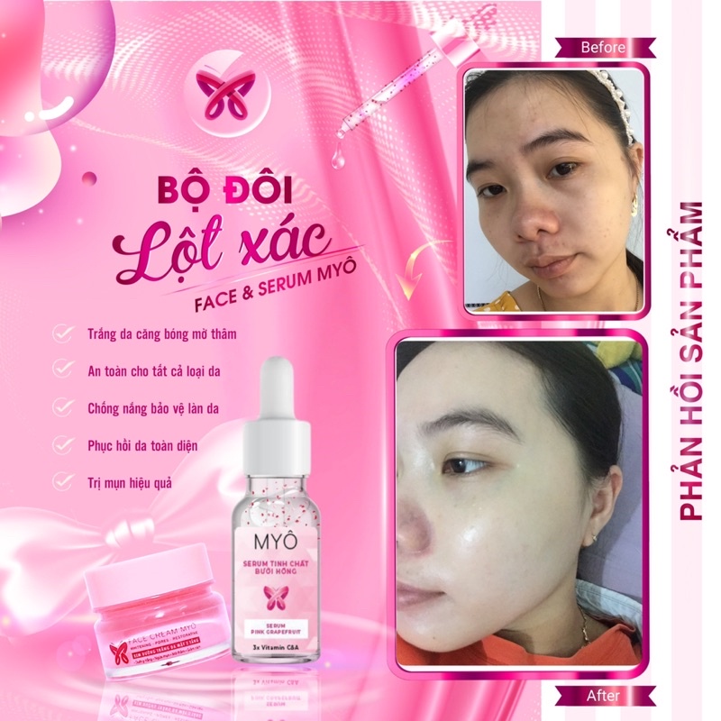 [CHÍNH HÃNG] COMBO SERUM + FACE 2TẦNG Dưỡng TrẮng Da Căng Bóng Mỗi Ngày