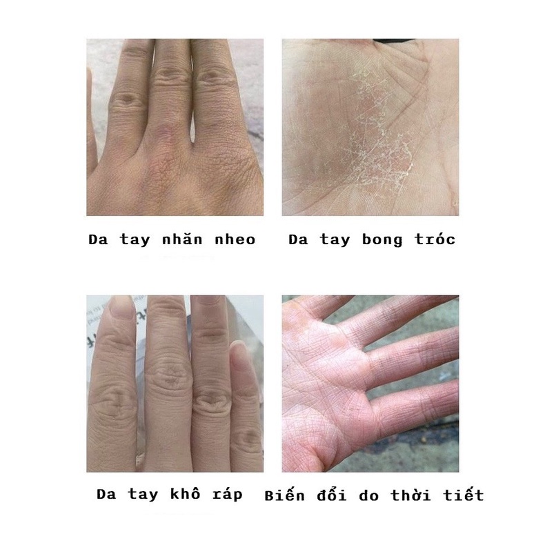 Top 10 Kem Dưỡng Da Tinh chất dưỡng da tay YINBA chiết xuất Hyaluronic Acid, Serum Dưỡng Ẩm Làm Mềm Da Tay Cao Cấp 30g