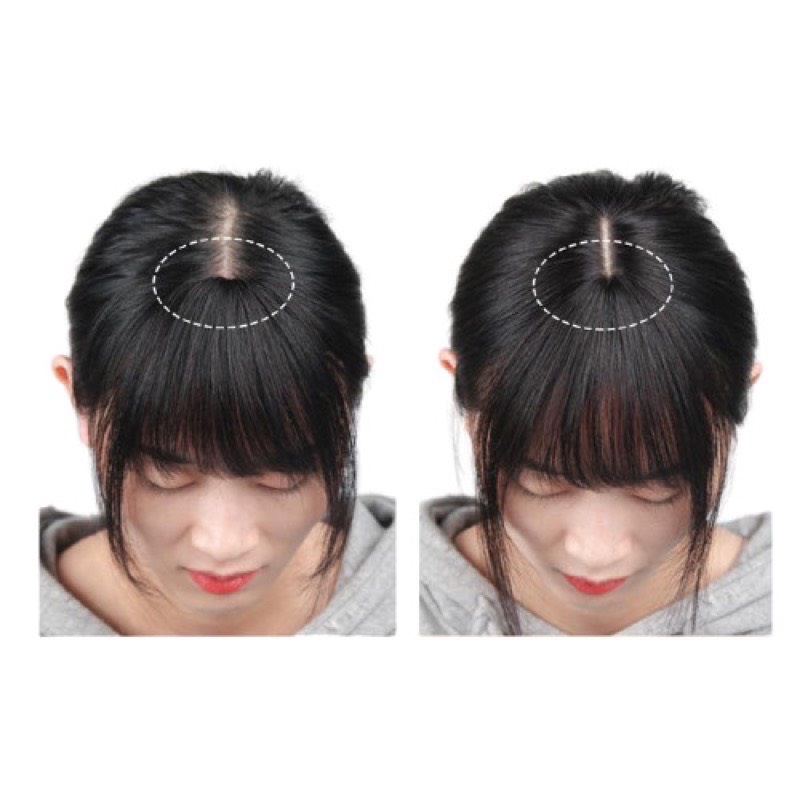 Tóc giả mái che hói sợi tơ cao  làm dầy tóc