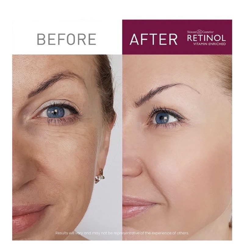 Serum Làm giảm các dấu hiệu lão hóa và khôiphục độ đàn hồi và tông màu cho làn da của bạn Retinol Vitamin Enriched Anti-