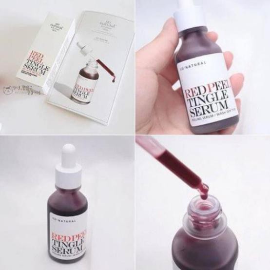 [FREESHIP] Red Peel Tingle Serum Ngừa Mụn AHA BHA So Natural Hàn Quốc