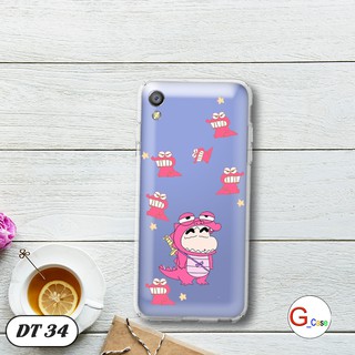Ốp lưng dẻo cho OPPO F1 Plus/ R9