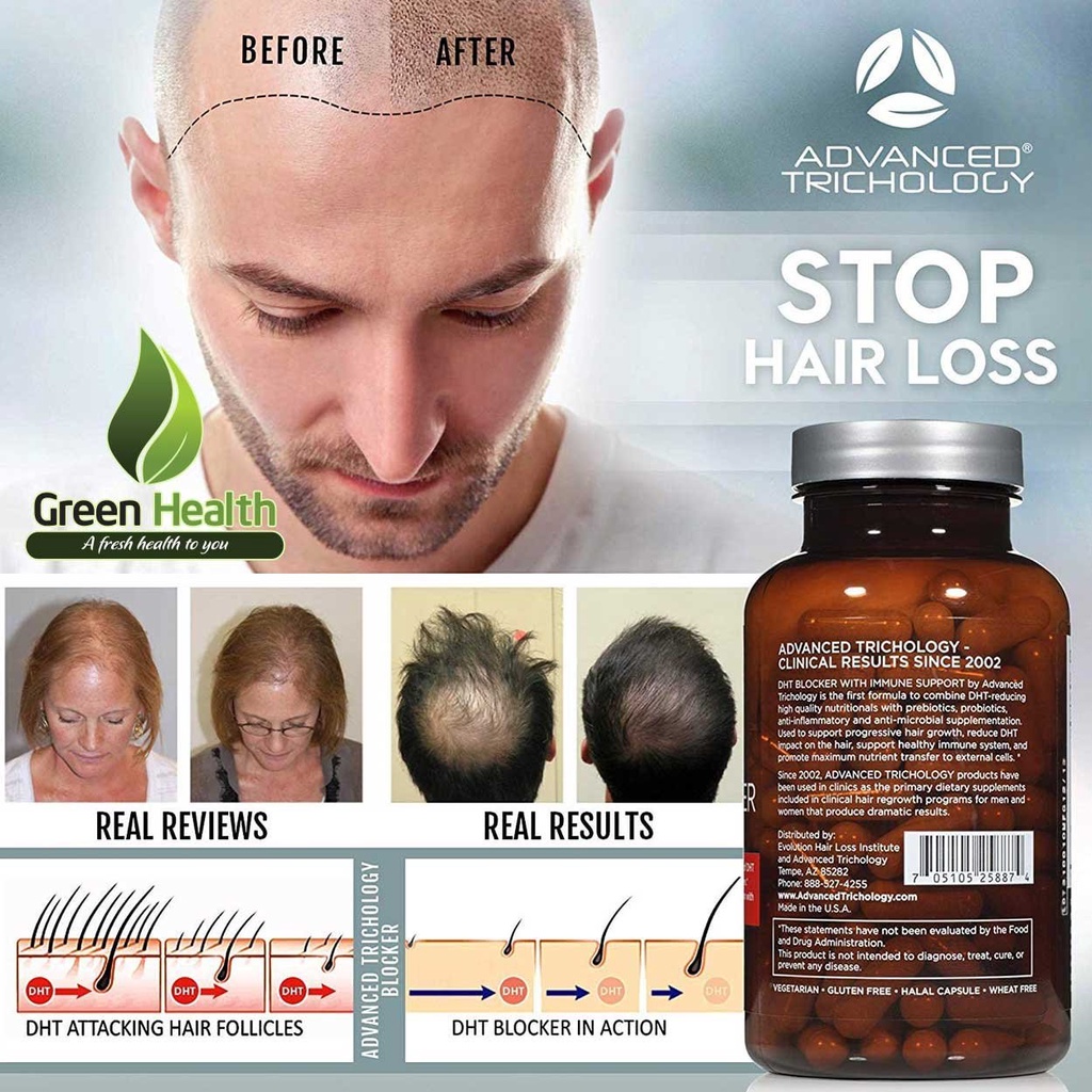 COMBO Mọc tóc Minoxidil & Finasteride 5% - Morr F5
