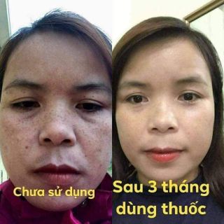 Thảo dược Mộc Linh Chi (50ml)
