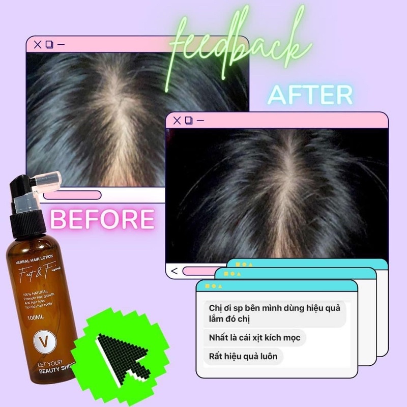 Xịt bưởi kích mọc tóc nhanh dài ngăn rụng tóc VyvyHairCare