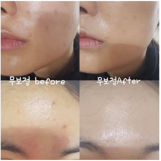 Phấn Nước Medicube