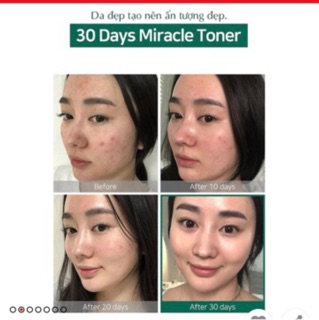 🆘Toner AHA – BHA – PHA 30 Days Miracle Toner