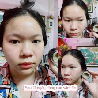 Cao Mụn Sâm Đỏ MEEA ORGANIC 15g/5g