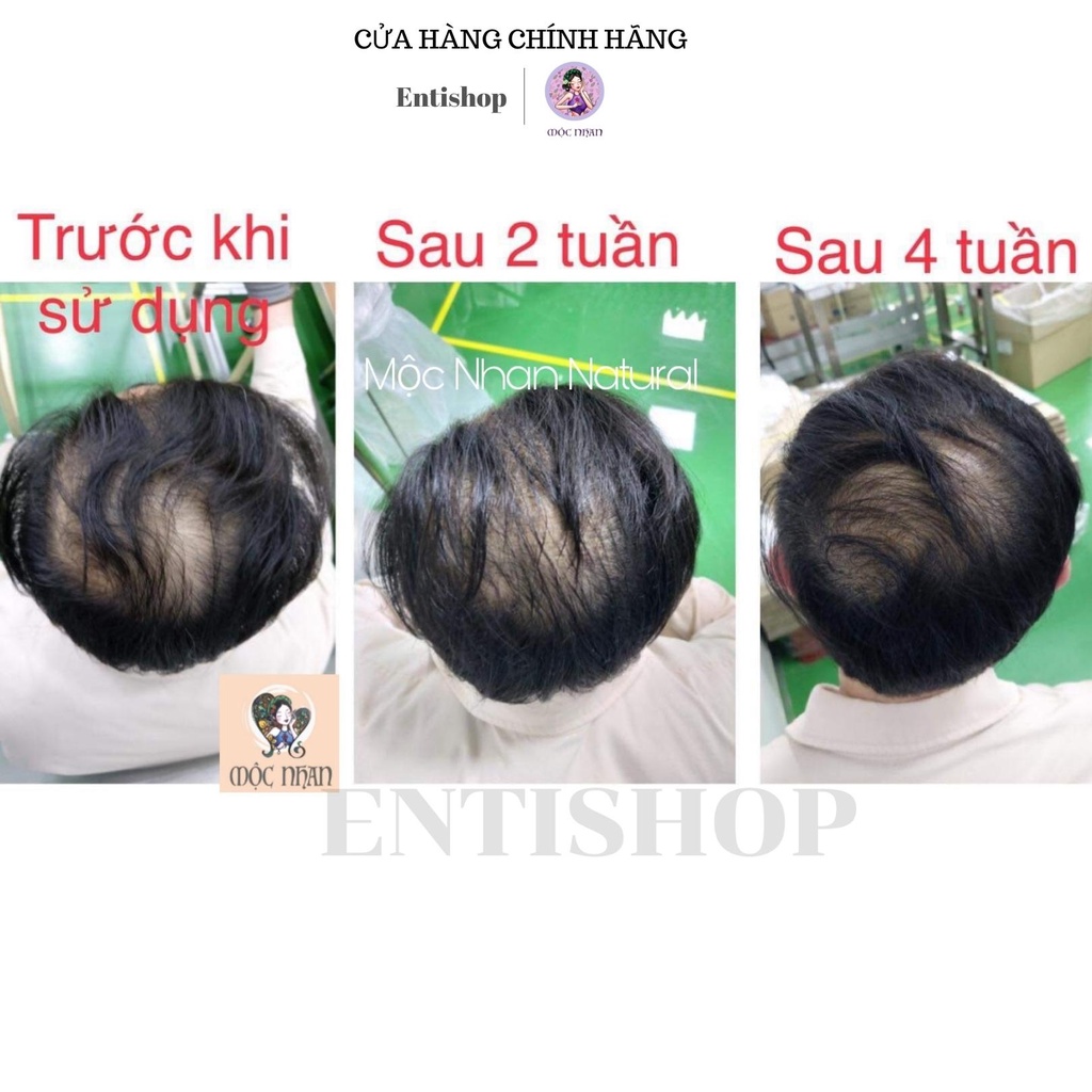 Dầu gội thảo dược Ả đào, bồ kết thiên nhiên cỏ cây giảm rụng, giúp tóc chắc khỏe MỘC NHAN 500ml