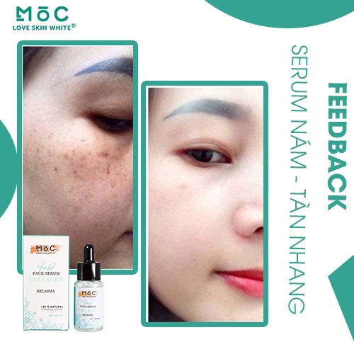 Tinh chất ngăn ngừa, làm giảm nám tàn nhang Collagen Mộc Love Skin White 25ml
