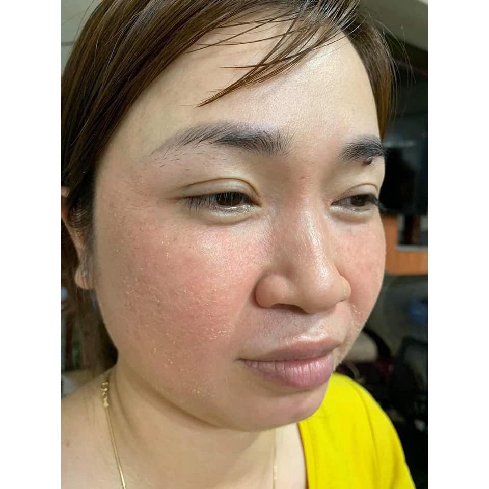 Cao Cấp Dịch Chiết Thảo Mộc Làm Sạch Nám - Tàn Nhang - Thâm Mụn Almonds 50ml .. | BigBuy360 - bigbuy360.vn