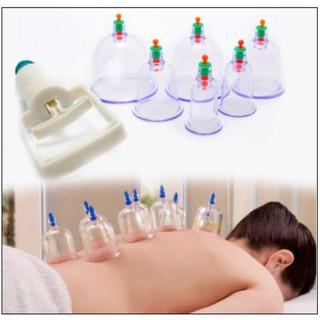 Bộ giác hơi 12 món không dùng lửa