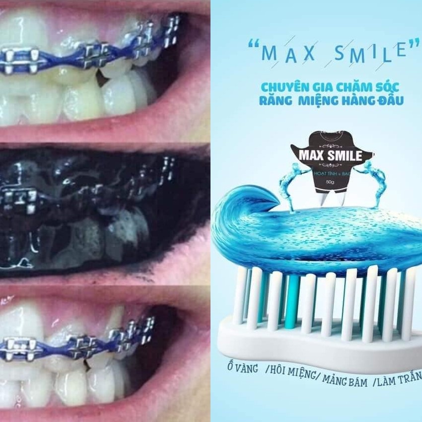 Than hoạt tính MAX SMILE khử mồi hôi miệng, giảm ố vàng, răng trắng tự nhiên