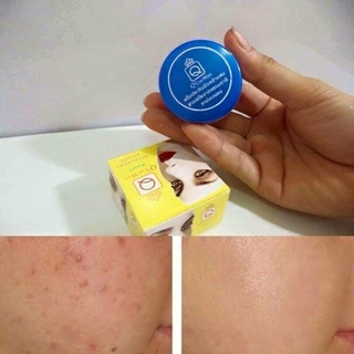 Kem Nghệ Trắng Da Q' Care White.