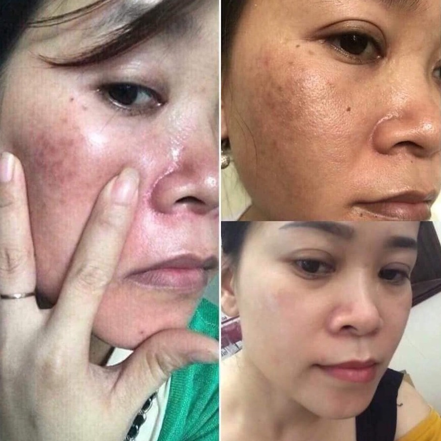 Viên Uống Trắng Da White - Ngừa Nám - Trắng Sáng Da Hiệu quả | Thế Giới Skin Care