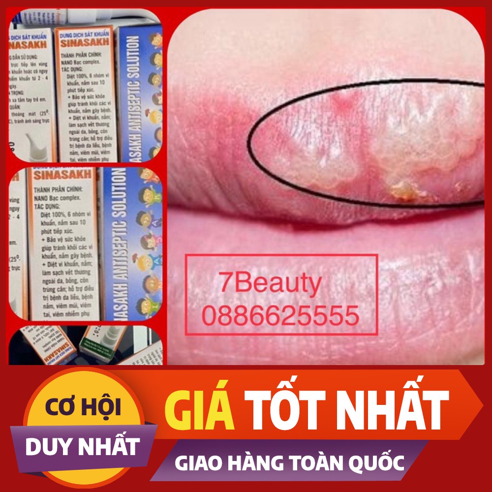 DUNG DỊCH SÁT KHUẨN SINASAHK