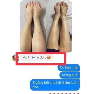 SERUM JIUHE THÂM BYE BYE MELANO