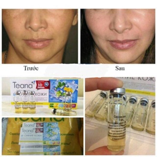 ❤️DEAL SHOCK:❤️COLLAGEN TƯƠI TENNA NGA DATE 2020