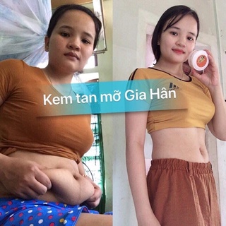 Kem ủ tiêu mỡ gia hân chính hãng
