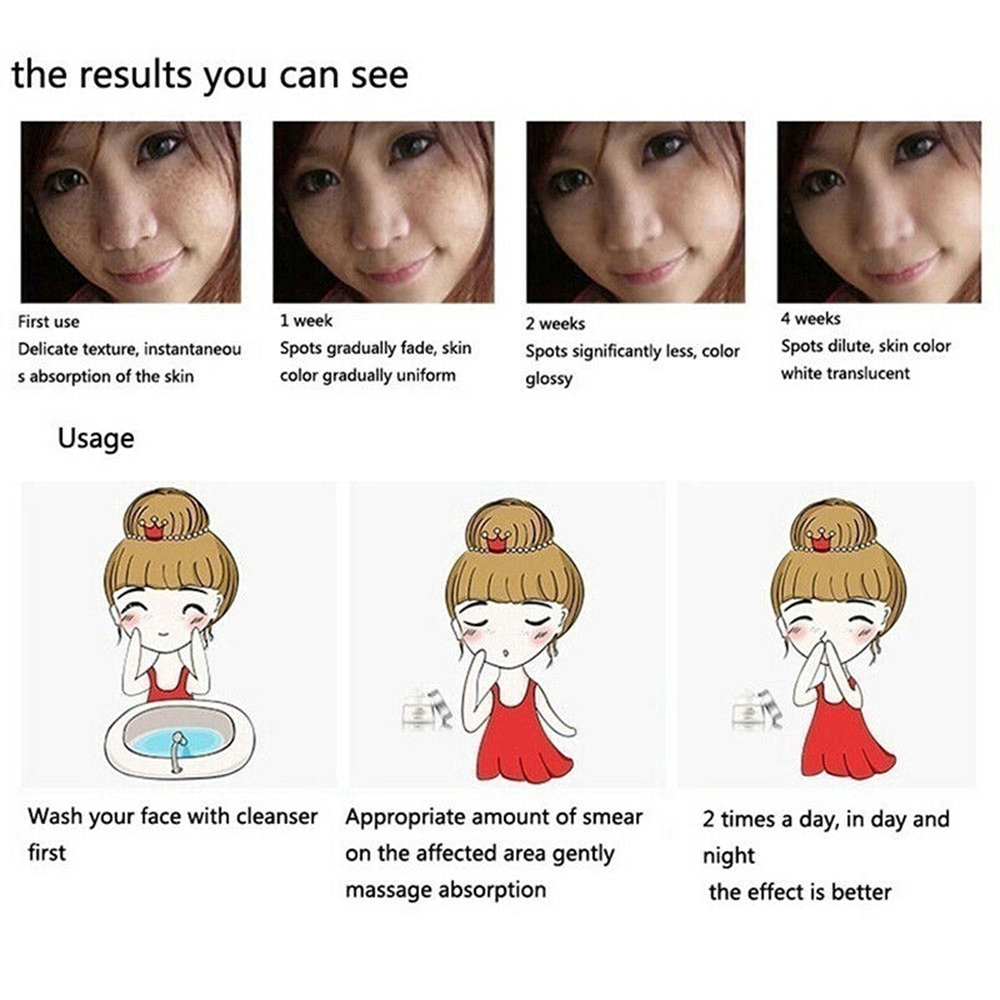 [Hàng mới về] Kem xóa tàn nhang 30g làm trắng phục hồi và chăm sóc da hiệu quả