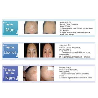 B-TOX PEEL 2 MÀU (DÀNH CHO SPA)