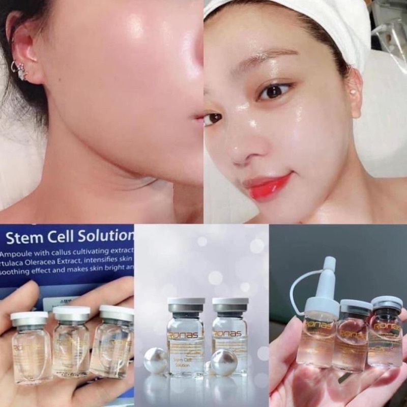 Tế Bào Gốc Ronas Chính Hãng - Bao Check Mã Vạch