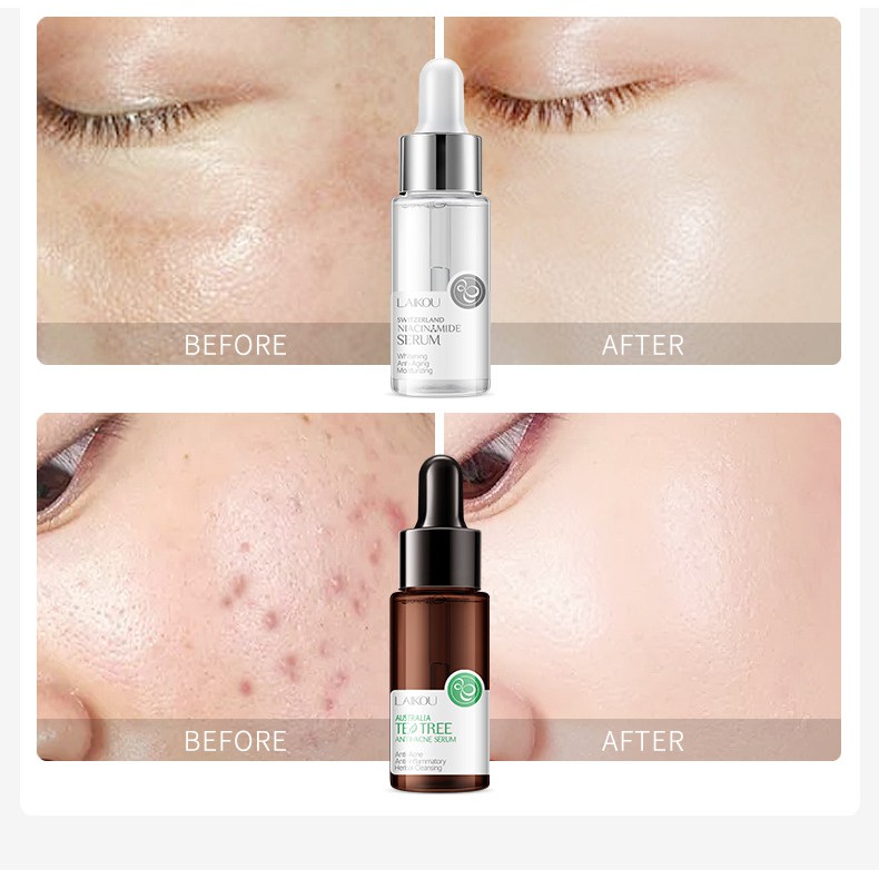 Serum Dưỡng Da Mặt LAIKOU Dưỡng Ẩm Làm Trắng Da, Giảm thâm, Giảm mụn giúp dưỡng ẩm da Hàng Nội Địa Trung