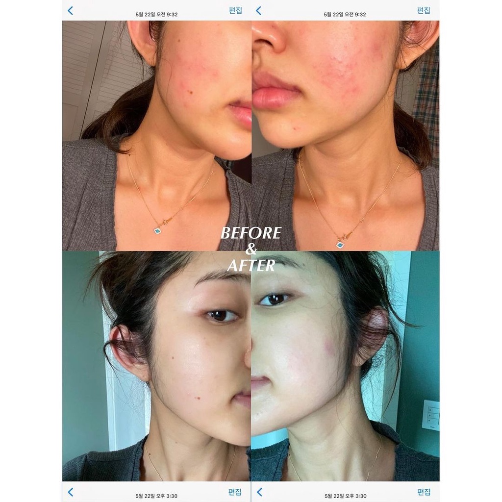 Mặt Nạ Luvum Real Calmingpair Cicadrogel MaskPack